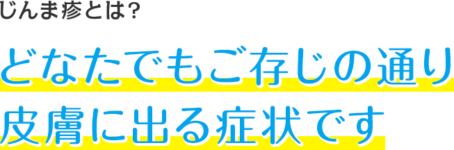 じんま疹とは？ どなたでもご存じの通り皮膚に出る症状です